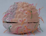 Diffuse Axonal Injury